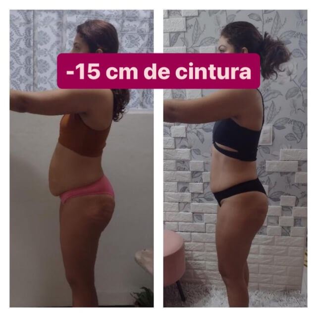 02-Antes X Depois - 15CM Média