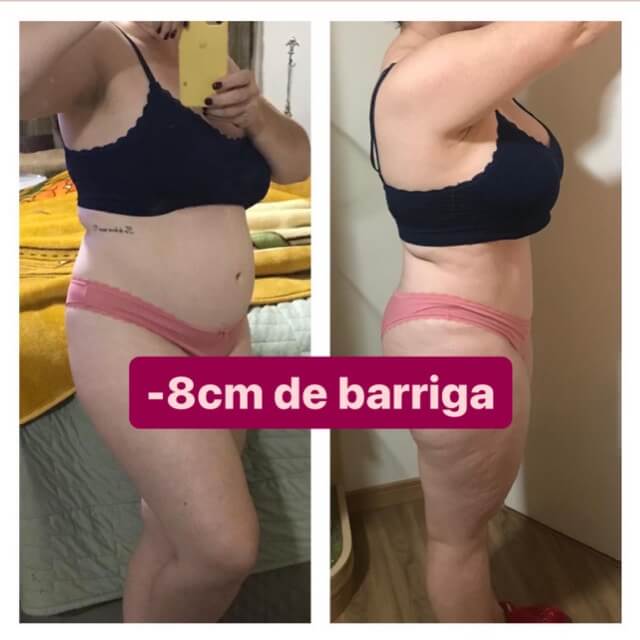 03-Antes X Depois - 8CM Média