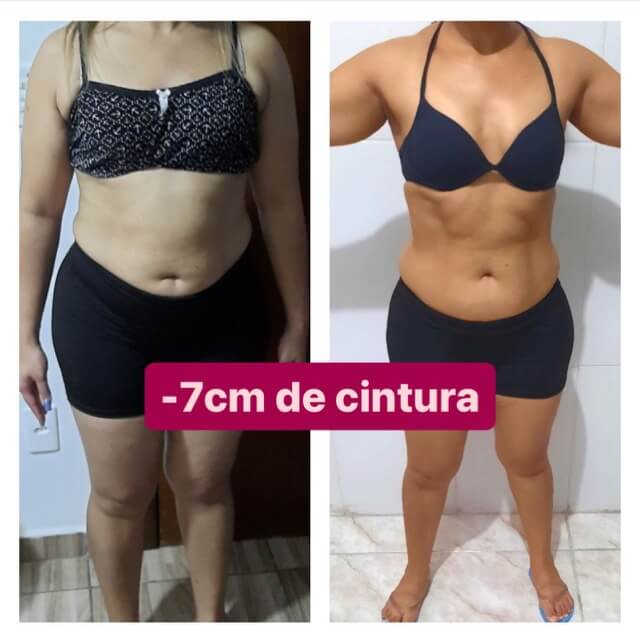 04-Antes X Depois - 7CM Média