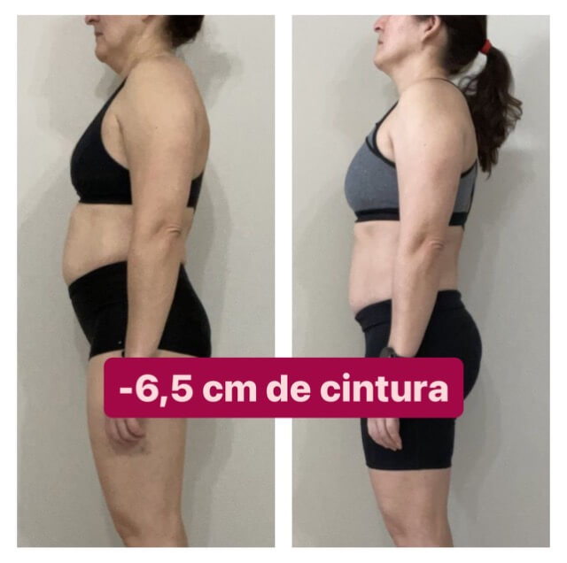 05-Antes X Depois - 6.5CM Média