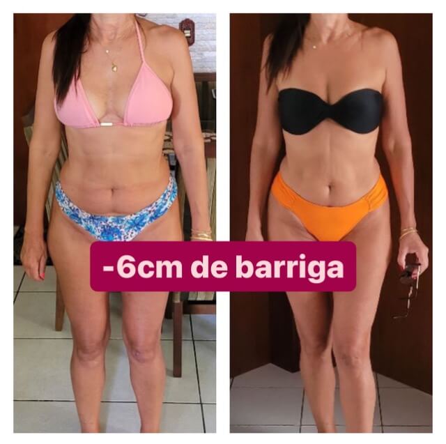 06-Antes X Depois - 6CM Média