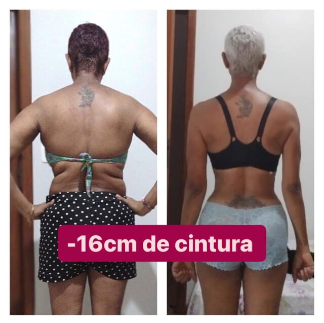 07-Antes X Depois - 16CM Média