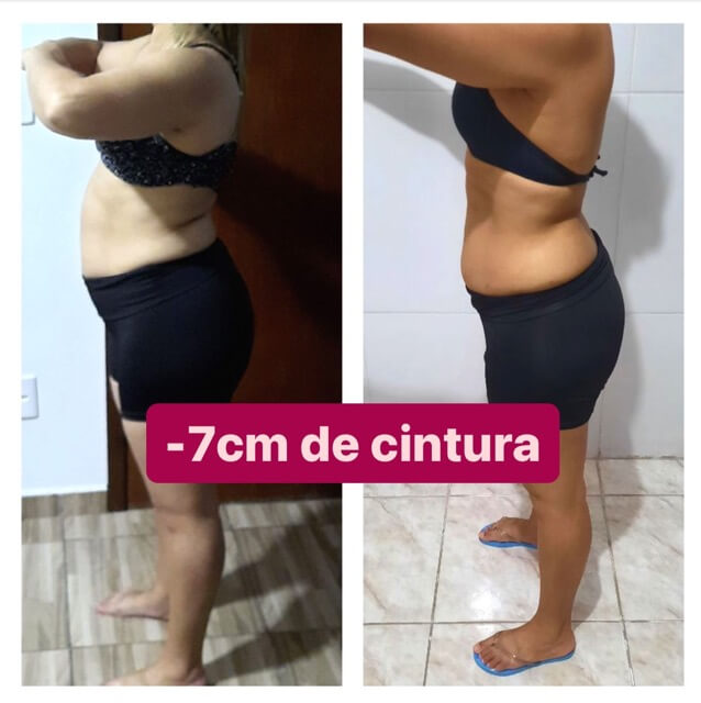 08-Antes X Depois - 7CM [2] Média
